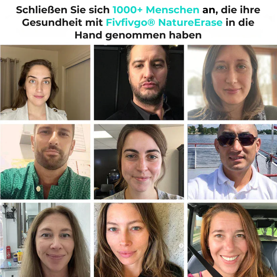 ✅ Offizieller Laden: Fivfivgo® NatureErase Sofortiges Gel zur Entfernung von Muttermalen und Flecken