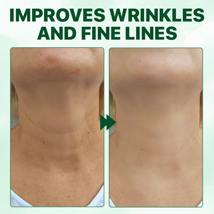 Fivfivgo® Advanced Skin Firming Oil