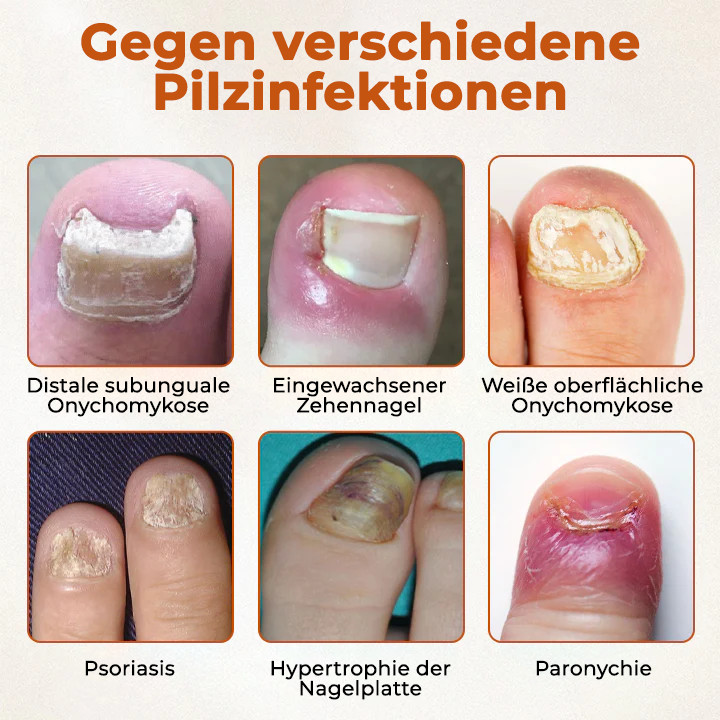 Fivfivgo® BeeShield Pilzlinderungstropfen