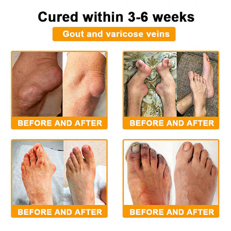 NovaRX®  Bee Venom Pain-Relief Joint Soothing Spray