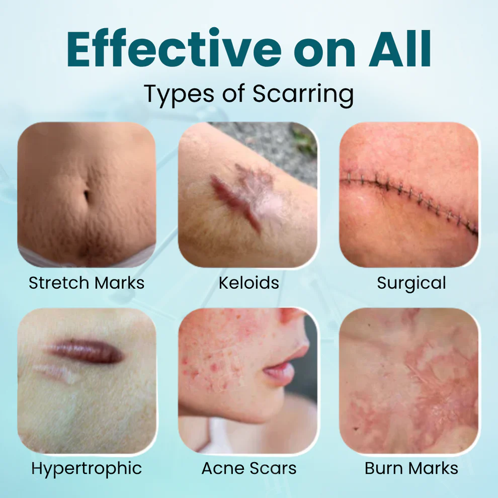 Fivfivgo® Advanced Scar Gel