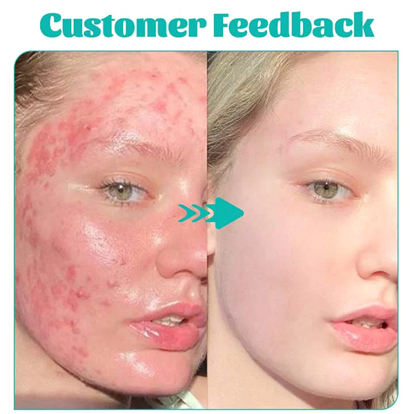 Fivfivgo™ Green Tea Gentle Cleansing Oil Control Mask