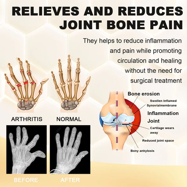 Fivfivgo™ Bee Venom Pain and Bone Healing Spray