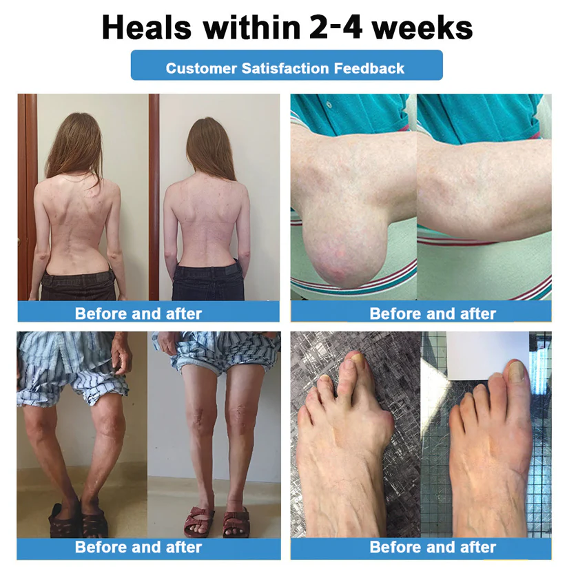 ✅ Official Store: Fivfivgo® Nano-Microneedle Joint Patch