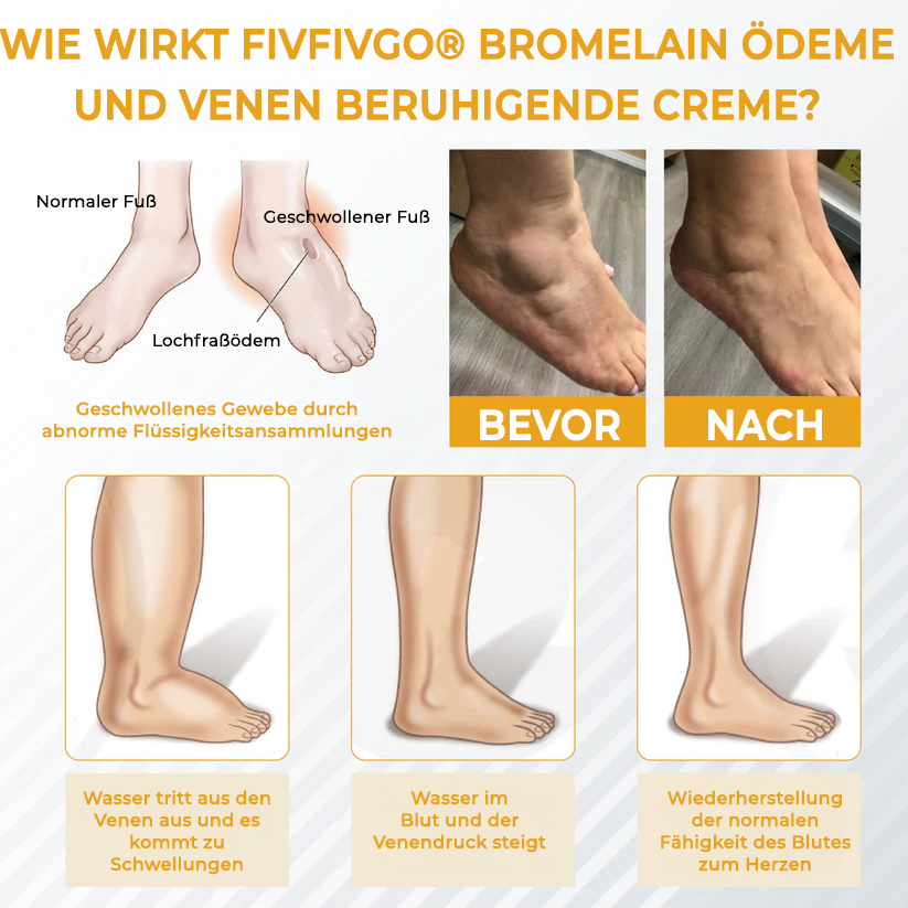 Fivfivgo® Bromelain Ödeme und Venen lindernde Creme