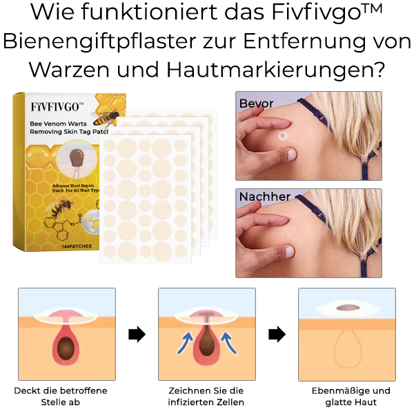 Fivfivgo™ Bienengift Warzen entfernen Haut Tag Patch