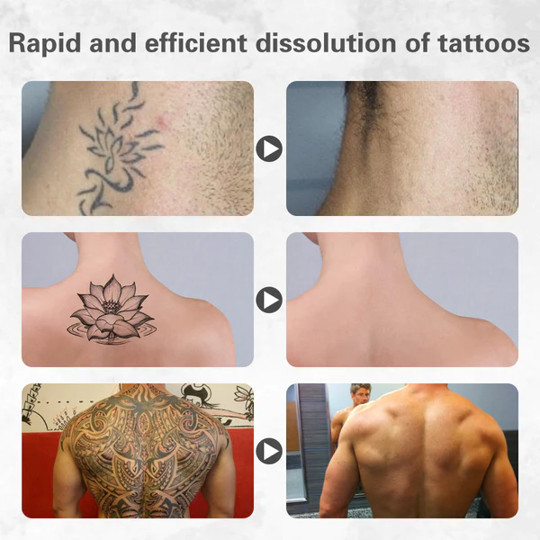 Fivfivgo™ Gel Dissolvant de Tatouage