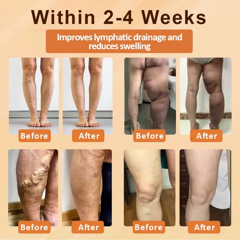 Fivfivgo™ EdemaSlim Care Detox Body Cream