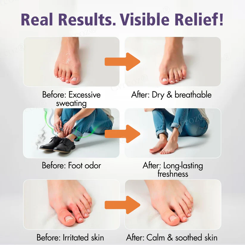 Cvreoz® FreshStep Foot Odor and Nail Fungus Spray