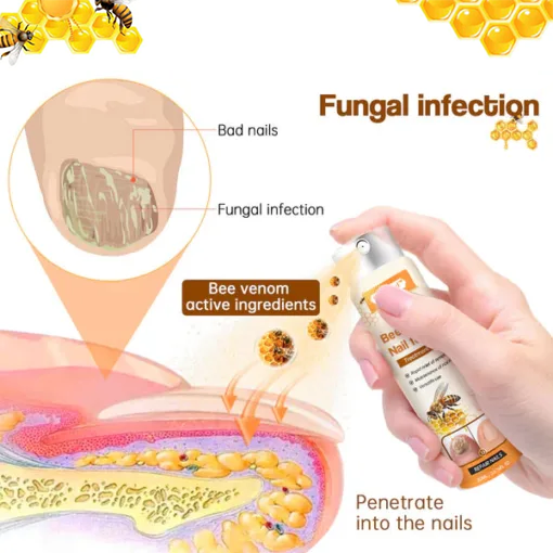 Fivfivgo™ Bee Venom Nail Fungus Treatment Spray