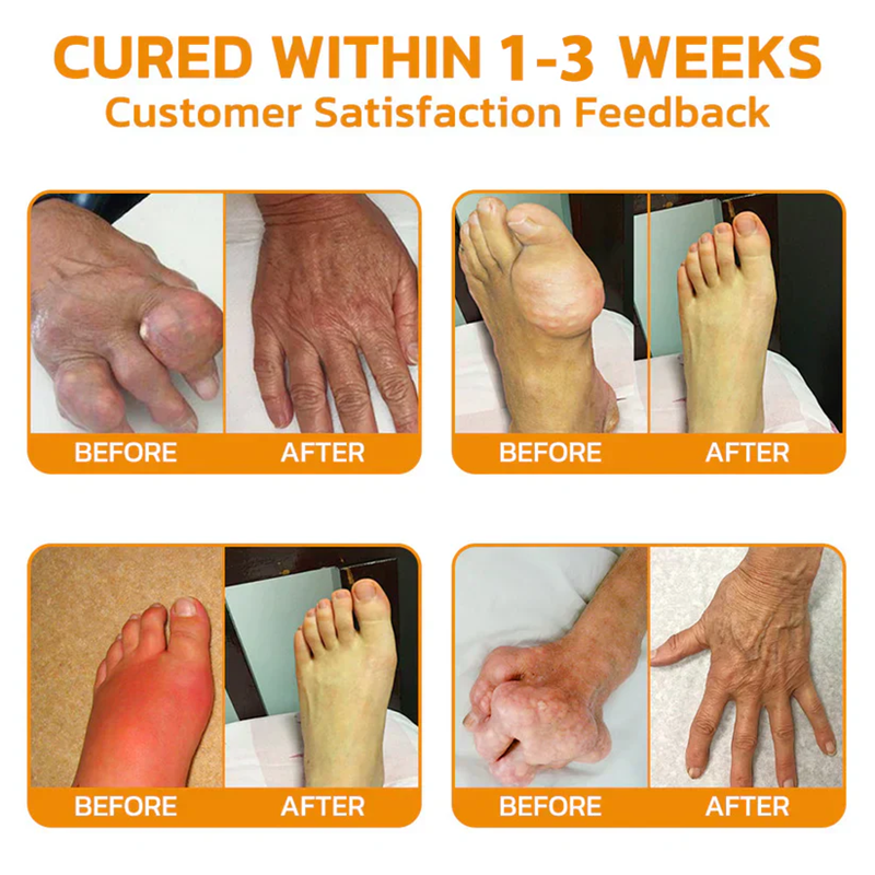 Fivfivgo™ Lidocain Gelenke Schmerzlinderung Heilung Liquid👨‍⚕️Orthopaedic Verband (BOA) genehmigt