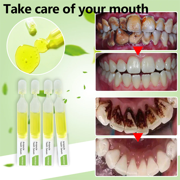 Fivfivgo™ Siero dentale in fiala