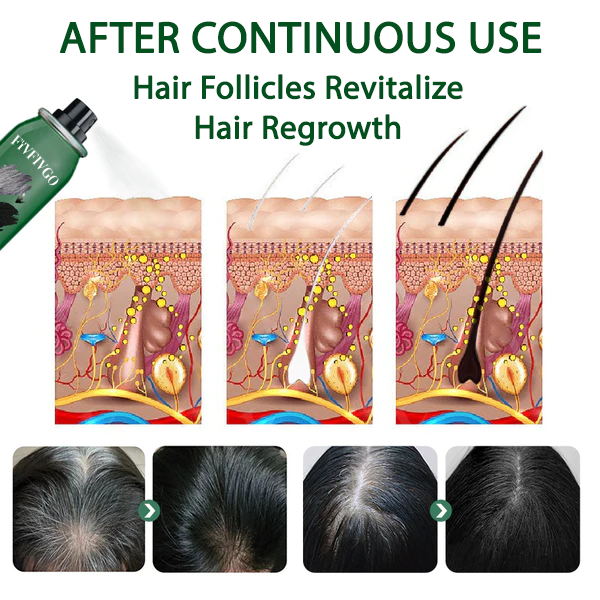 Fivfivgo™ GrayAway Instant Root Permanent Spray