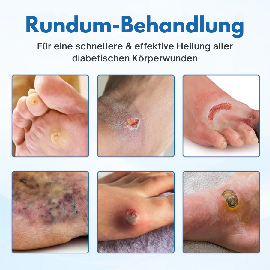 CZTICLE® DiabeHeal Hauterholungsband
