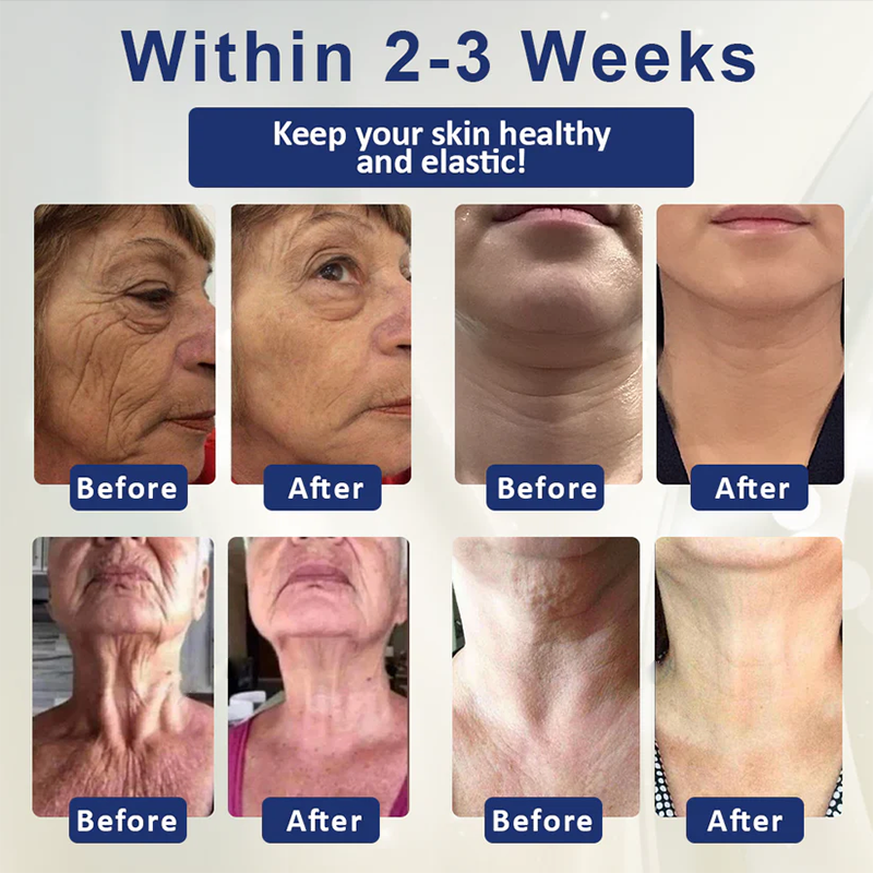 Fivfivgo™ Deep Elastic SkinRenew HA Cream