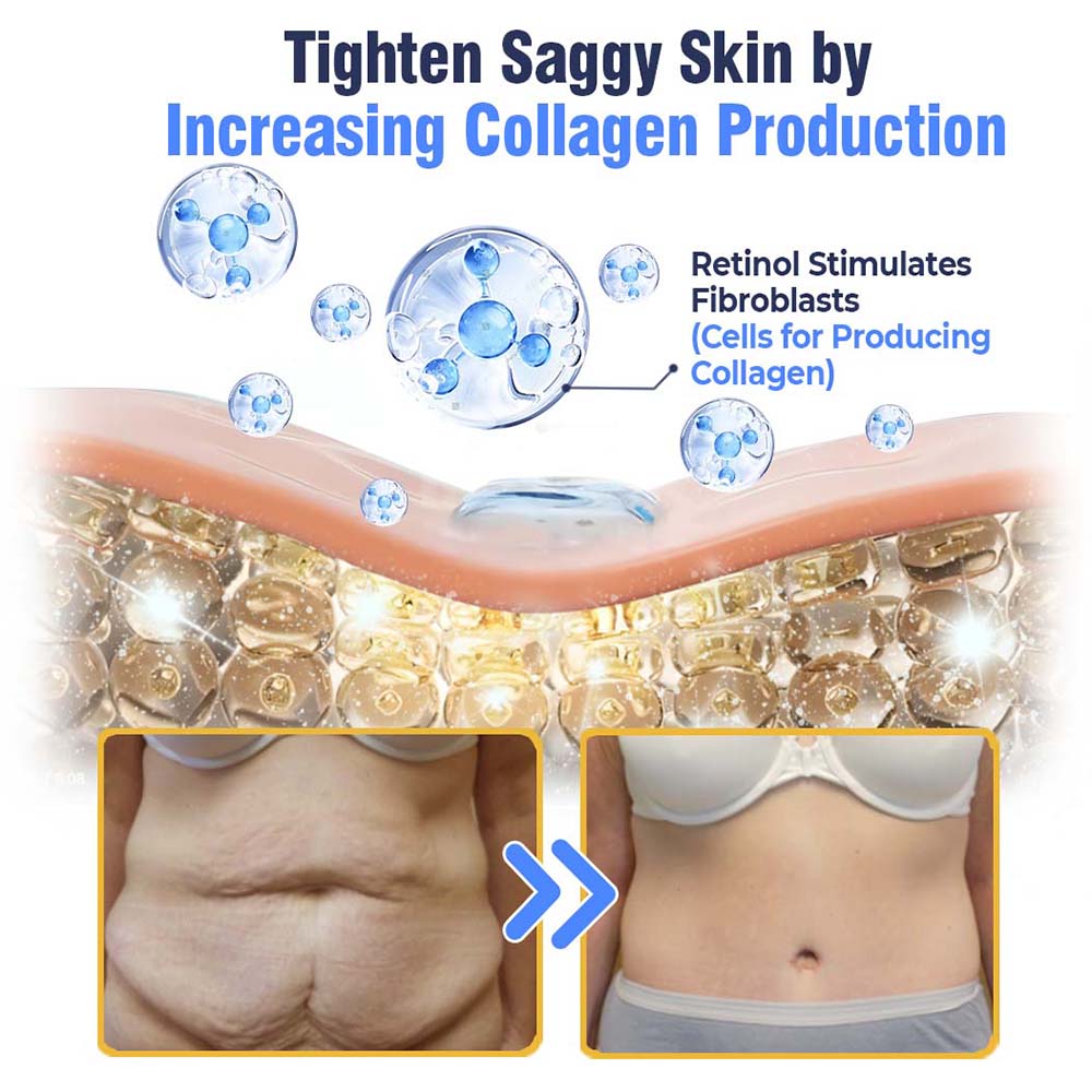 Fivfivgo™ Advanced Tightening & Wrinkles Reducing Lotion