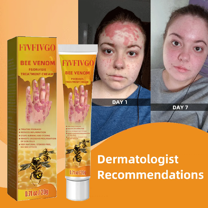 Fivfivgo™ Crema per il trattamento della psoriasi al veleno d'ape