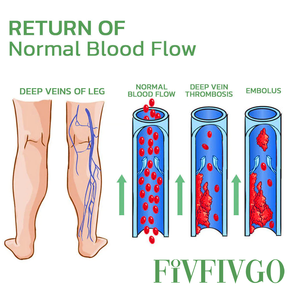 Fivfivgo™ Brucia Grassi Modellante e Vene Varicose Toppa con Perline Burst Sollievo Immediato