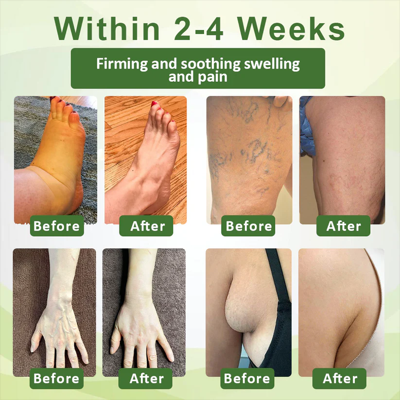 Fivfivgo™ SwellSoothe Lymphatische Creme