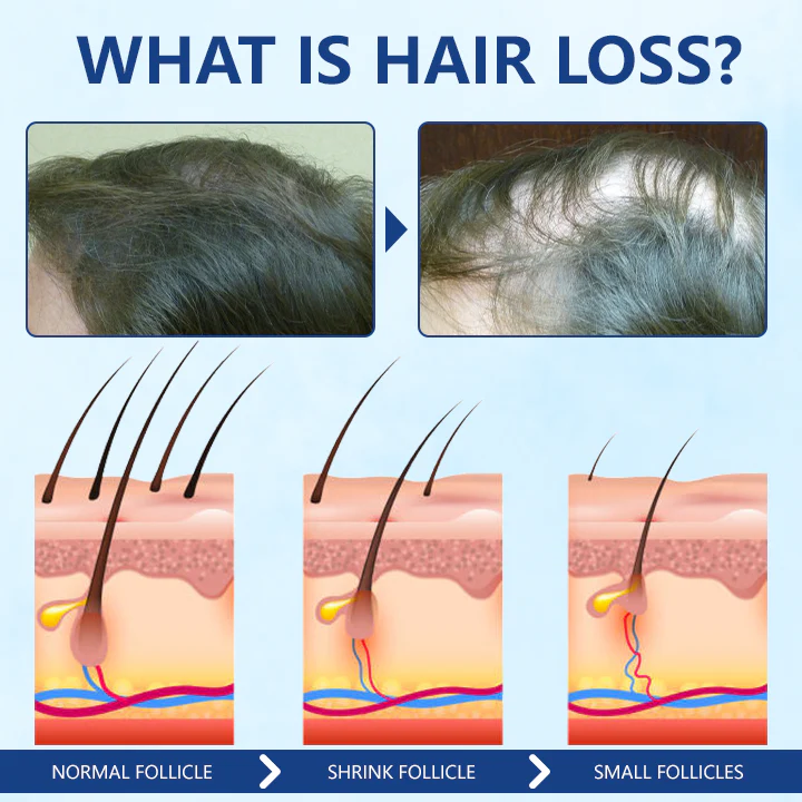 Fivfivgo™ RevitaRoot Haarwuchscreme
