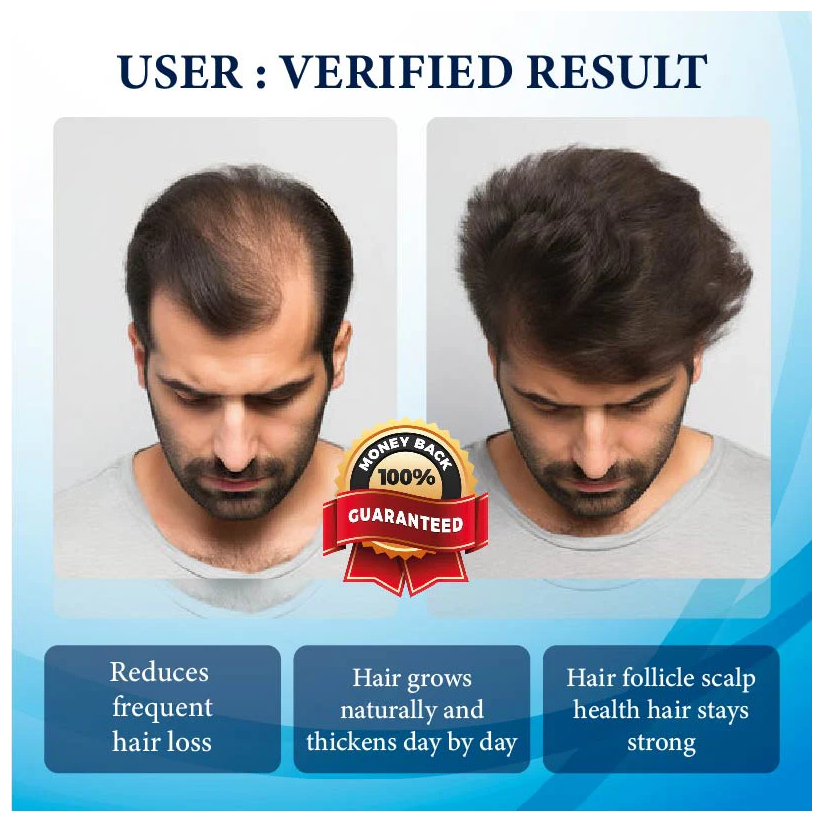 Fivfivgo™ ThickBoost Herbal HairGrowth Serum for Men