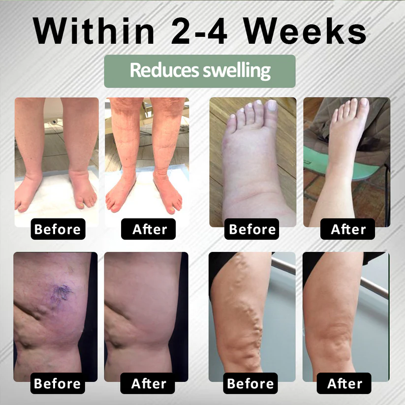 NovaRX® FlowBoost Edema Drain Herbal Roll On