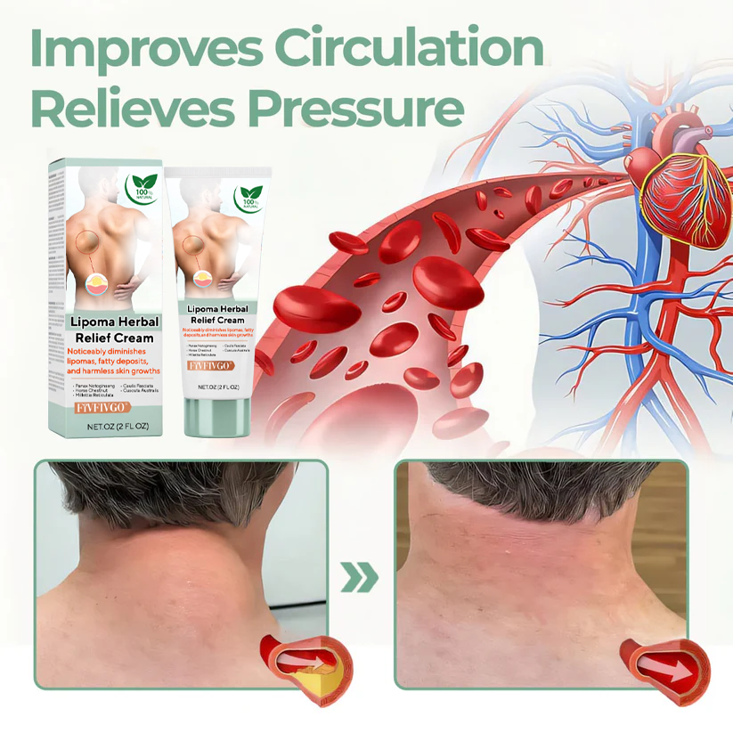 Fivfivgo® Lipoma Herbal Relief Cream