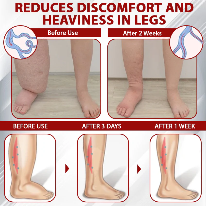 NovaRX® Red Vine FluidRelief Edema Gel