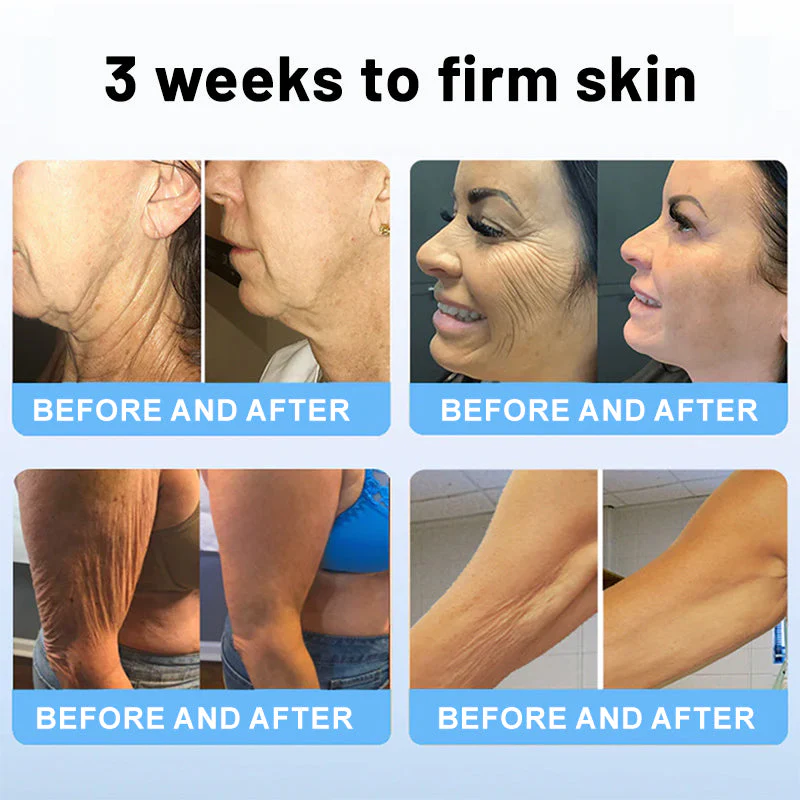 Fivfivgo™ Wrinkle Removel Cream (Address Crepe & Sagging)
