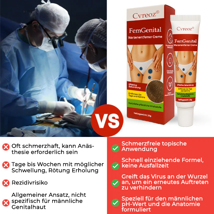 Cvreoz® FemGenital Warzenentferner Creme