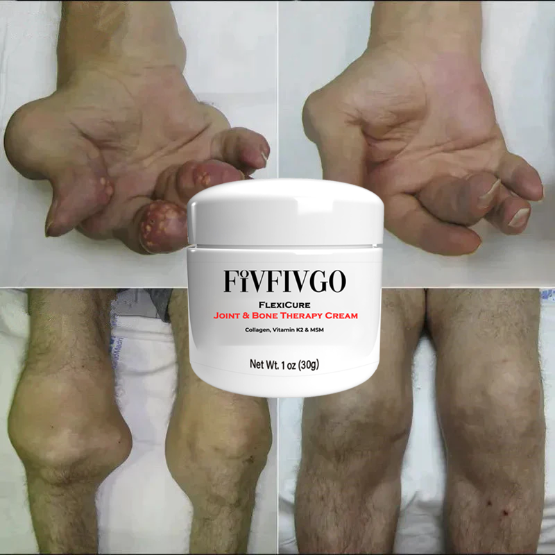 Fivfivgo™ FlexiCure kräm för led- och benbehandling
