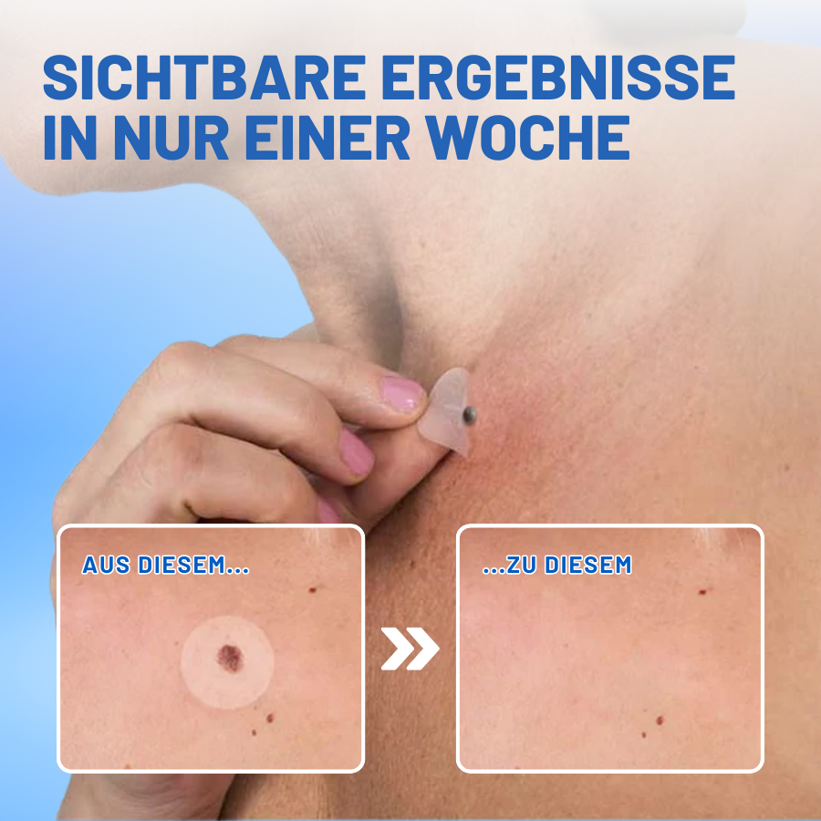 Fivfivgo™ Muttermale & Warzen entfernen Haut Tag Patch
