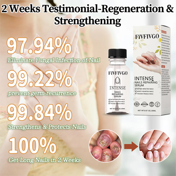 Fivfivgo™ NailGro Intensives Nagelwachstums- und Stärkungsserum