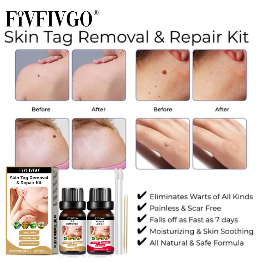 Fivfivgo® Skin Tag Removal & Repair Kit