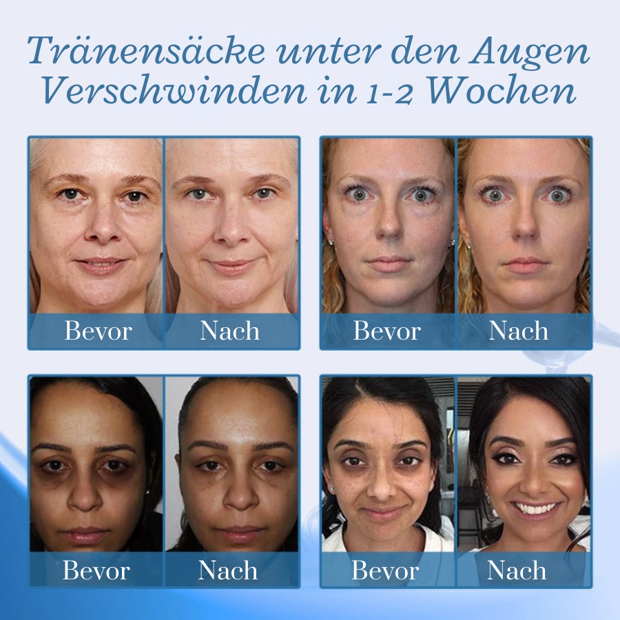 Fivfivgo® BotoxPLUS Retinol Augencreme - Dermatologe empfohlen (Augencreme gegen feine Linien, Falten, dunkle Augenringe, dunkle Flecken und tägliches Anti-Aging)
