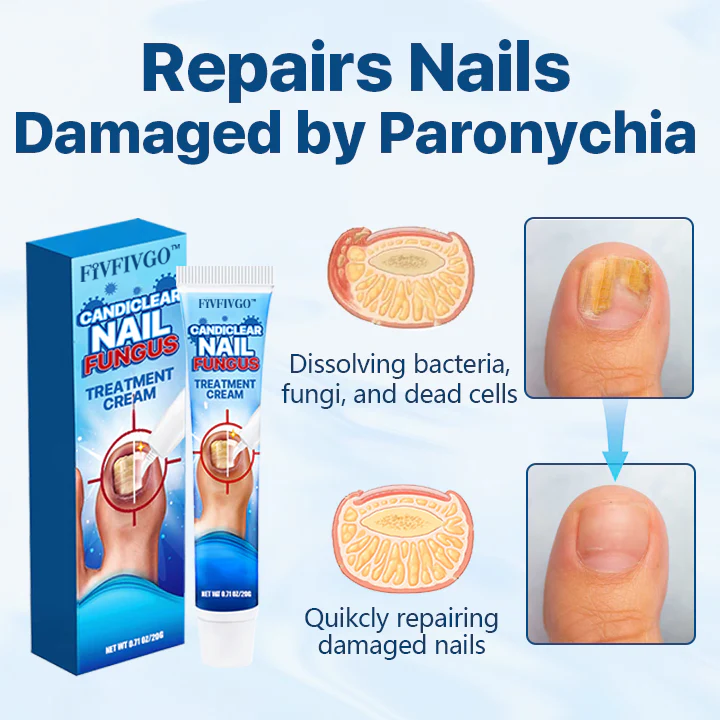 Fivfivgo™ Candiclear Nail Fungus Treatment Cream