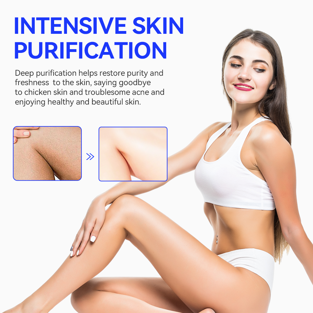 Fivfivgo™ Keratosis Pilaris & Acne Treatment Uppfriskande kräm för kroppen