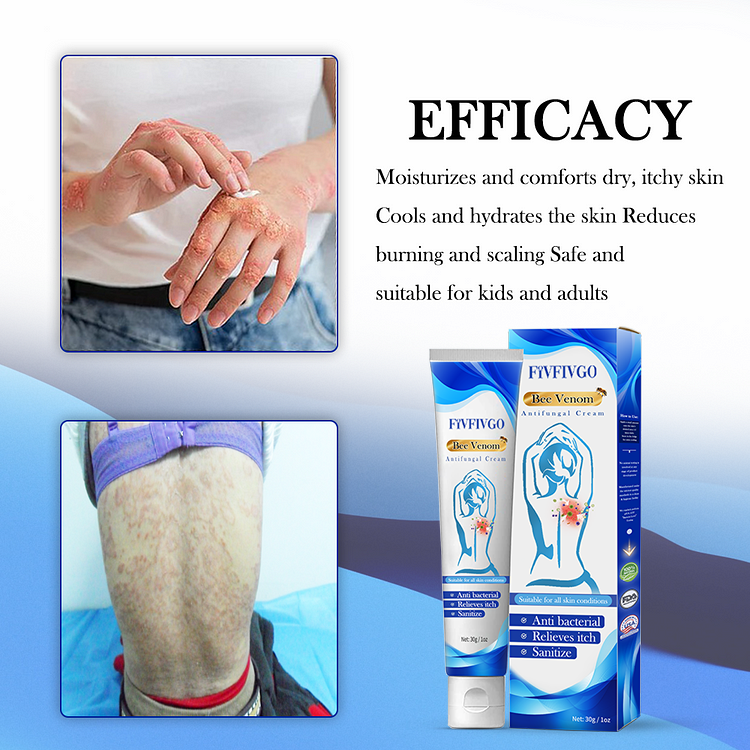 Fivfivgo™ Bienengift-Antimykotika-Creme