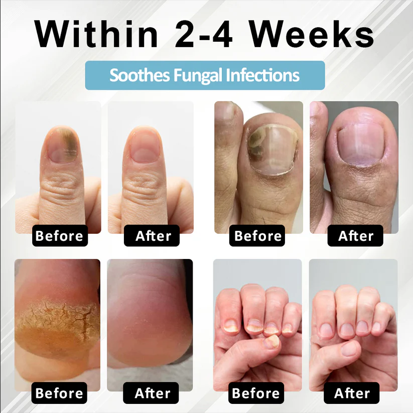 Fivfivgo® MycoStop Nail Recovery Serum Pen