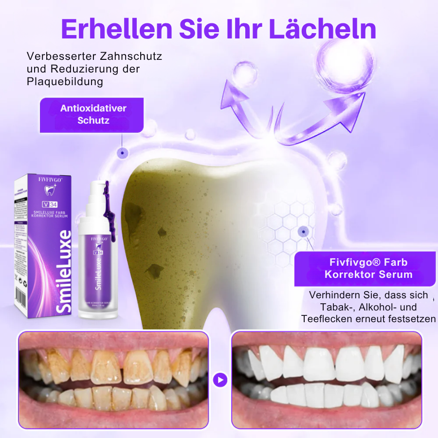Fivfivgo® Farb Korrektor Serum | Klinisch erwiesen, dass es Flecken sanft entfernt, die Zähne aufhellt und den natürlichen Glanz in nur 3 Tagen wiederherstellt - sicher für empfindliche Zähne und Zahnschmelz