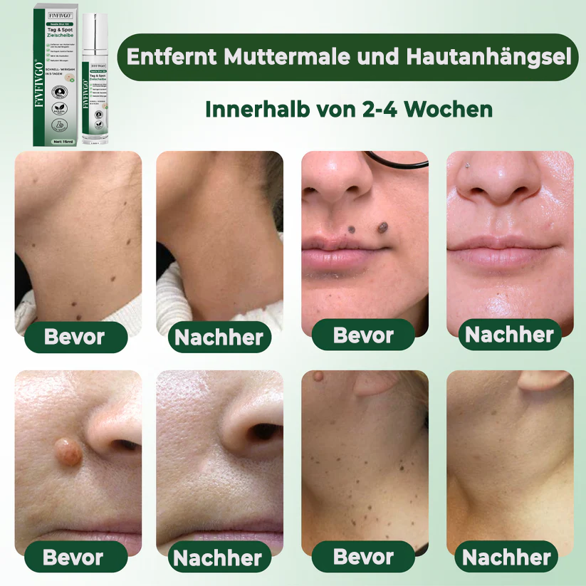 Fivfivgo® Reedle Shot 100 Tag & Spot Zielscheibe Fortgeschrittenes Serum