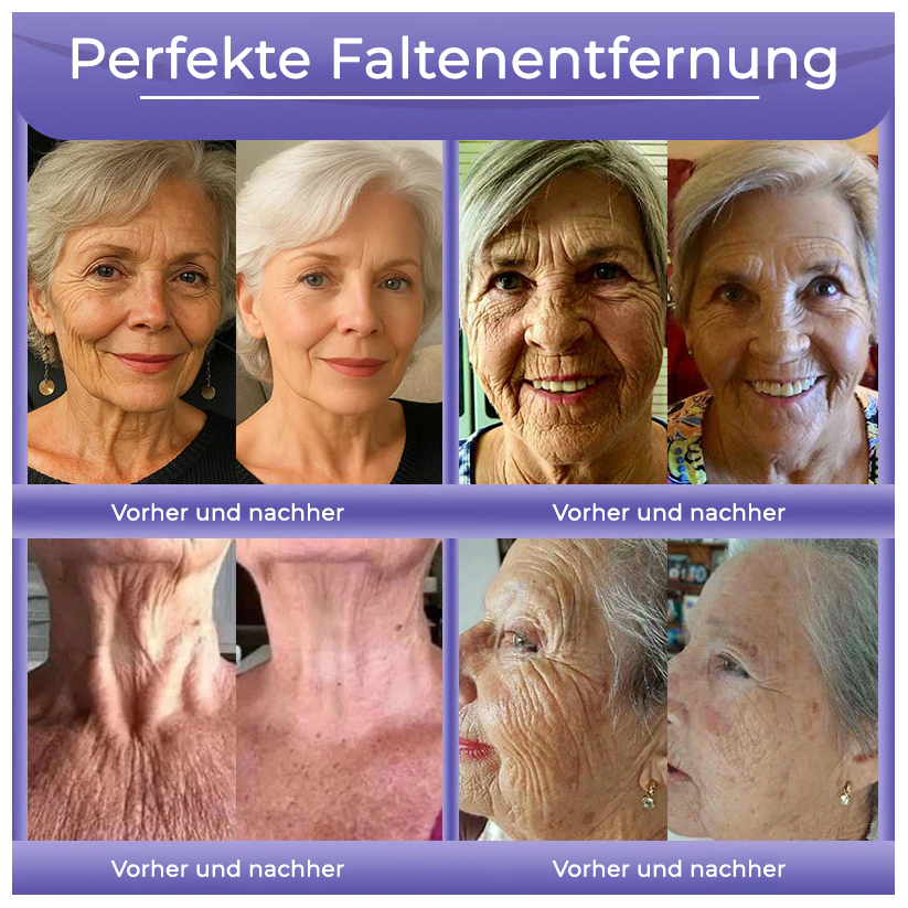 Fivfivgo® Anti-Falten-Hautcreme zum Entfernen von Falten, Straffen der Haut, Aufhellen - Last Day Sale🔥90% OFF