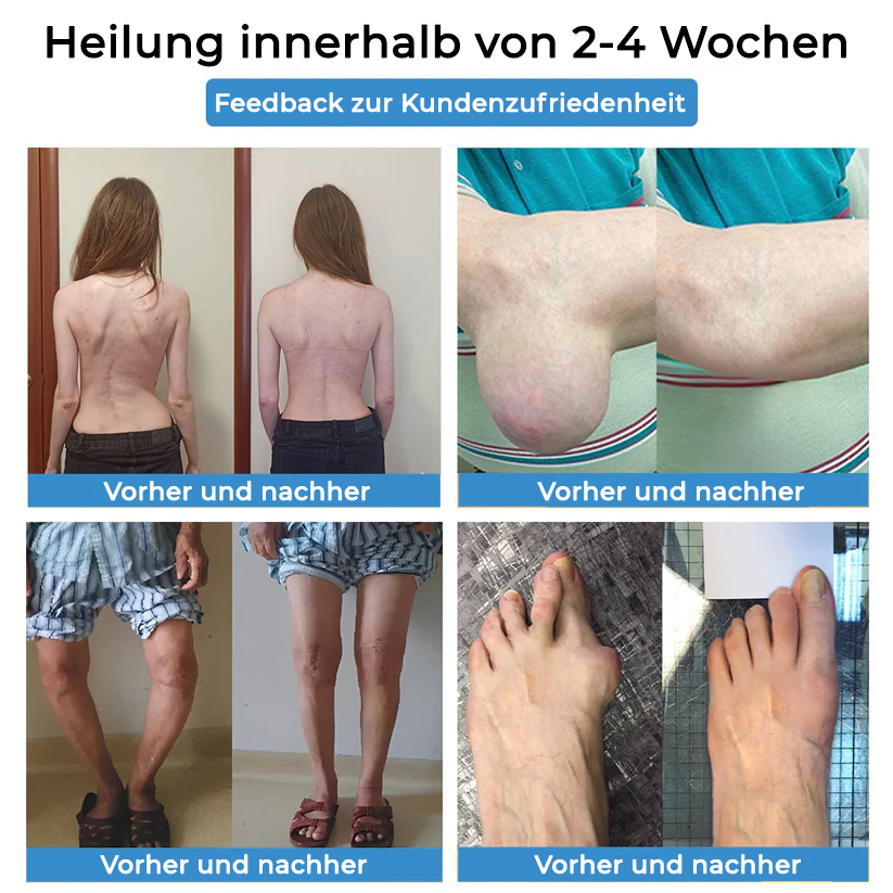 ✅ Offizieller Laden: Fivfivgo® Nano-Mikronadel-Gelenkpflaster