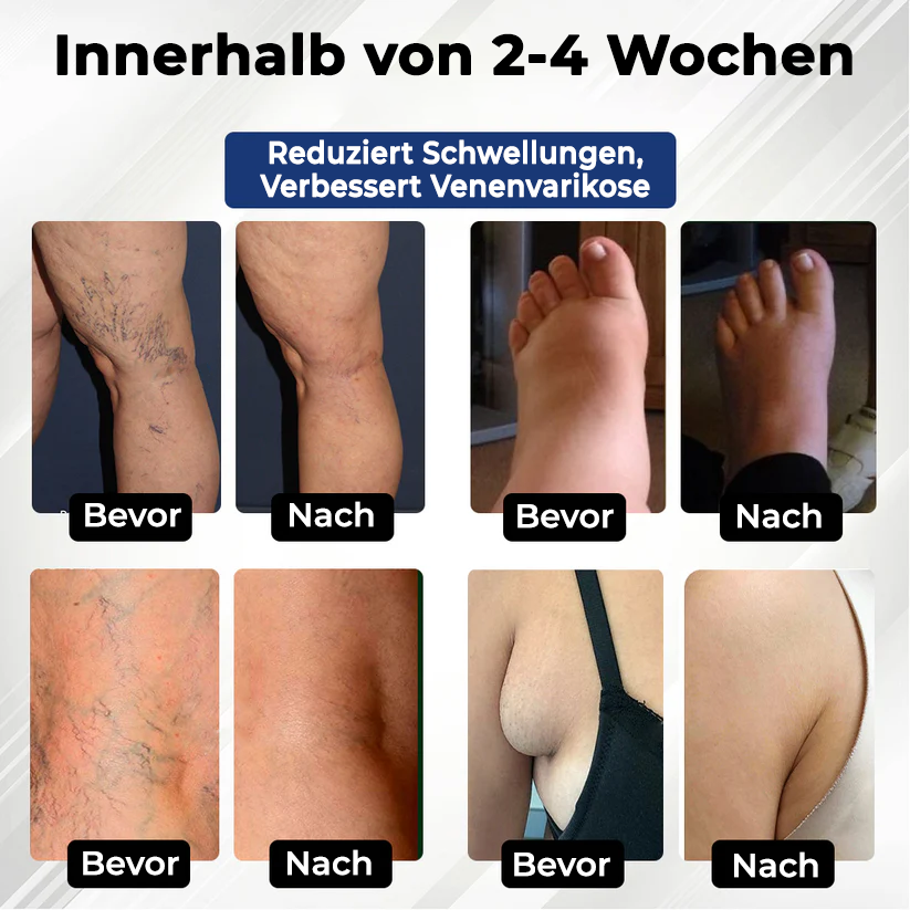 Fivfivgo® VenoHerb Schwarzkümmel-Ödemlöser-Balsam