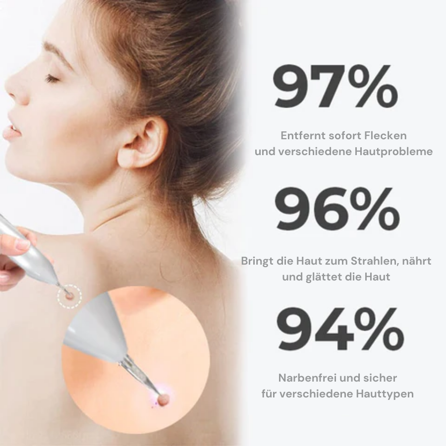 Fivfivgo™ Tragbarer Laser-Spot-Reinigungsstift
