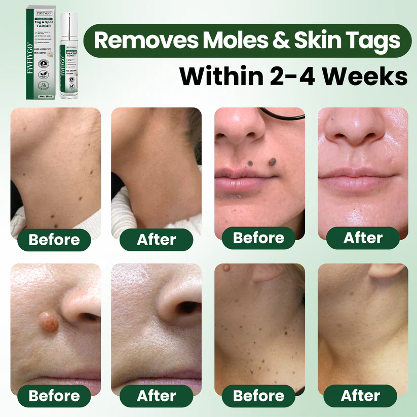 Fivfivgo® Reedle Shot 100 Tag & Spot Target Advanced Serum