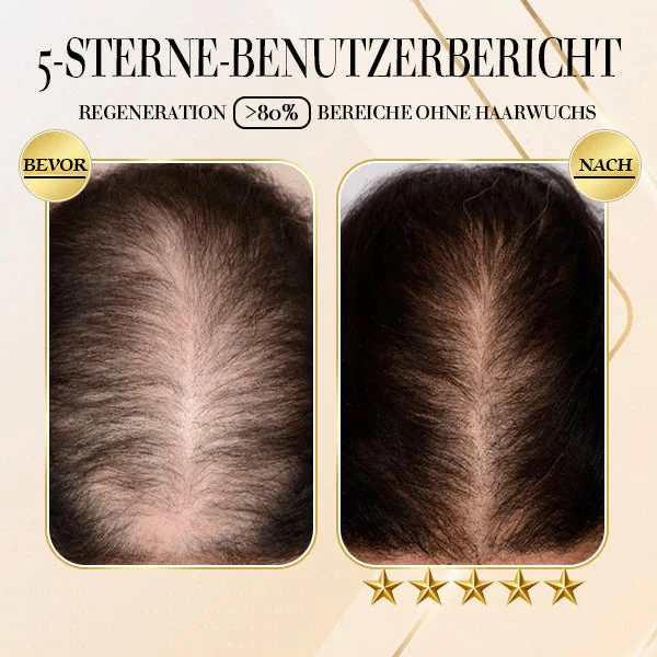 Fivfivgo™ Ingwer Haarwachstum Shampoo Bar