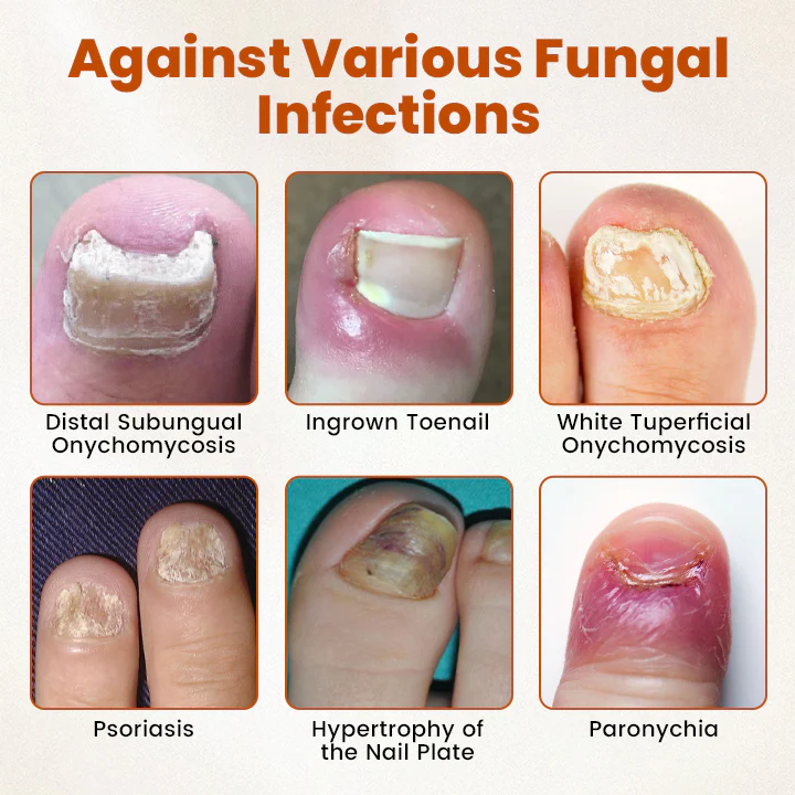 Fivfivgo® BeeShield Fungal Relief Drops