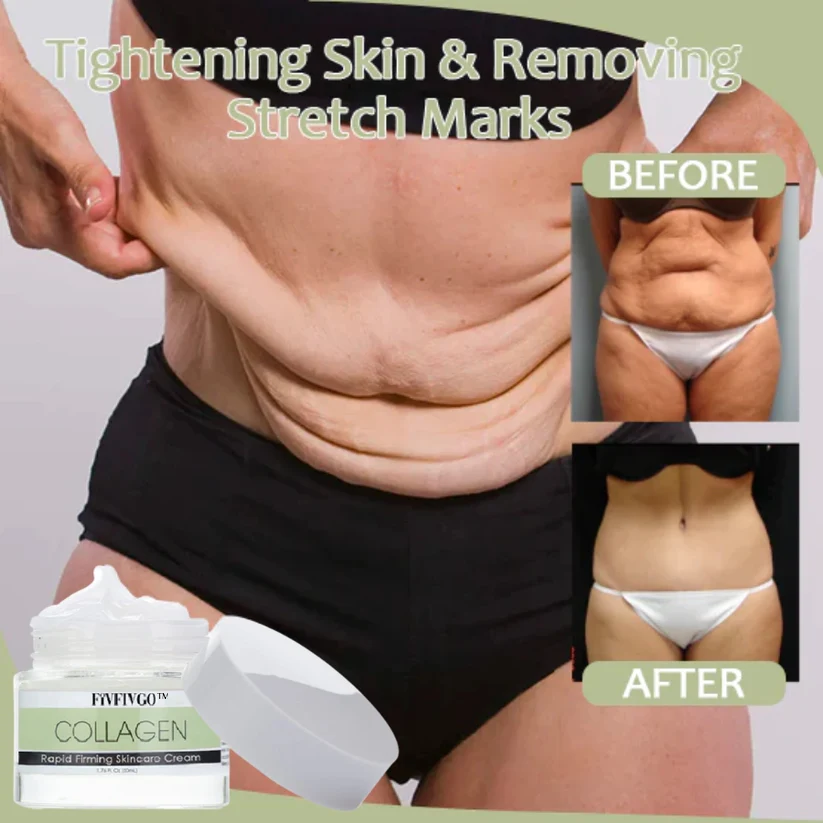 Fivfivgo™ Collagen Straffende Körpercreme