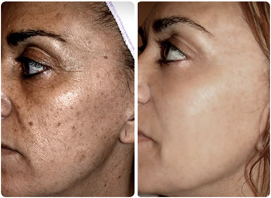 Fivfivgo™ PDRN DNA Reshaping Essence